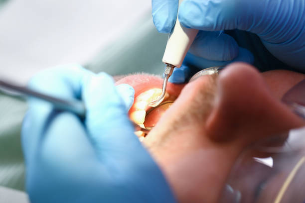 Best Emergency TMJ Treatment in Tuscola, IL