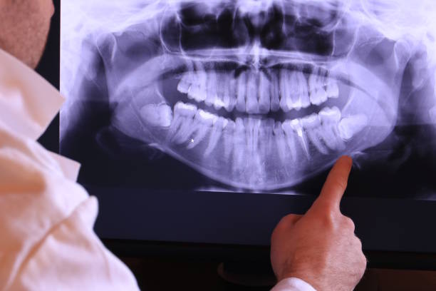 Best Pediatric Emergency Dentist in Tuscola, IL