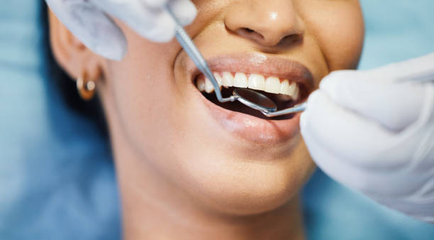 Best Emergency Treatment for Dental Infections or Abscesses in Tuscola, IL