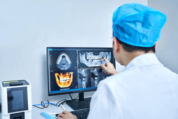Best Emergency Wisdom Teeth Removal in Tuscola, IL